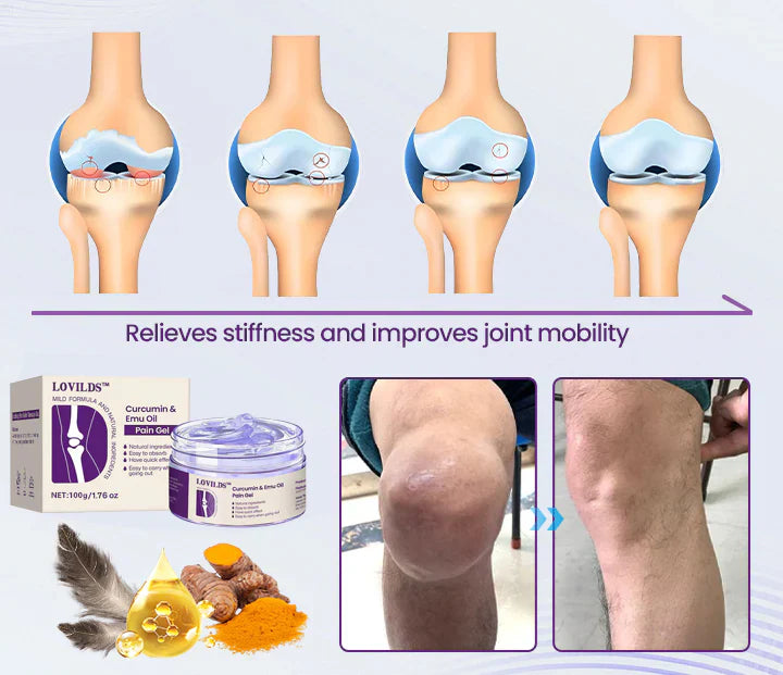 LOVILDS™ Curcumin & Emu Oil Pain Gel – 🏥Backed by US Osteopathic Experts