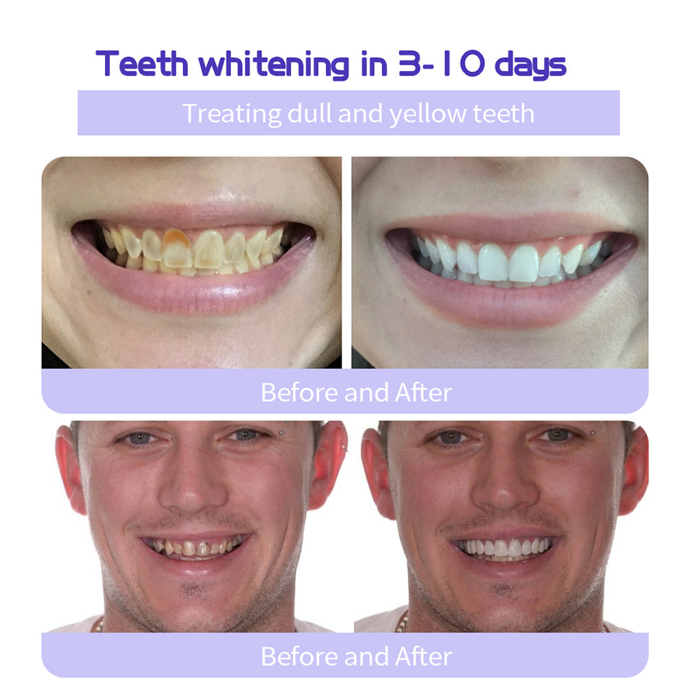 🦷 BBOJI™ Teeth Restoration Mineral Powder – Stronger Teeth, Healthier Smile, Visible Results