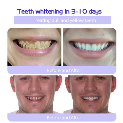 🦷 BBOJI™ Teeth Restoration Mineral Powder – Stronger Teeth, Healthier Smile, Visible Results