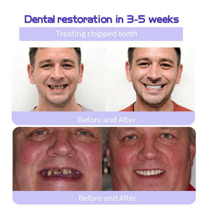 🦷 BBOJI™ Teeth Restoration Mineral Powder – Stronger Teeth, Healthier Smile, Visible Results