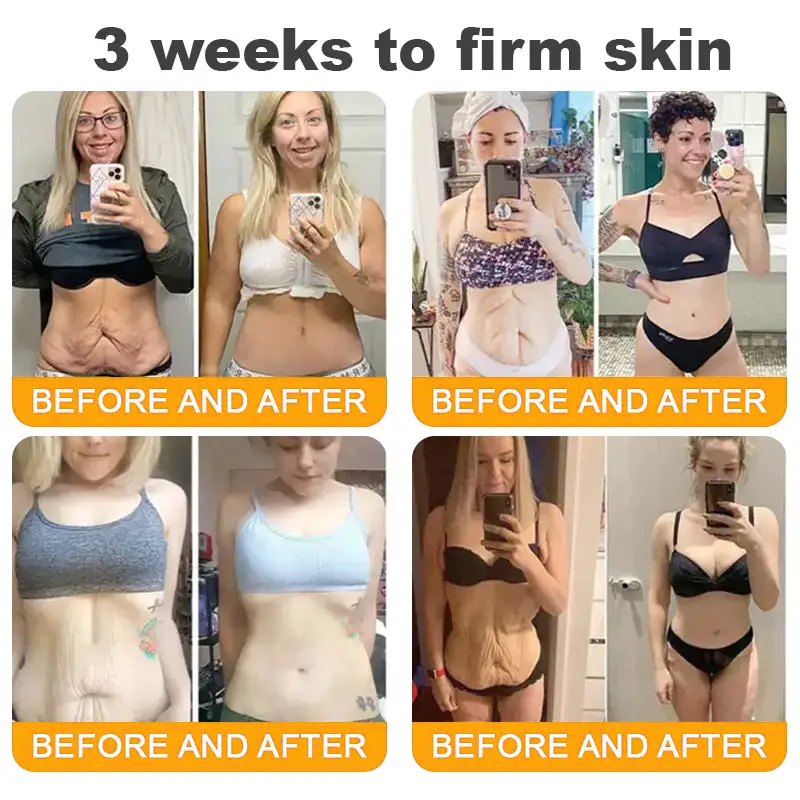 ✨FDA Approved:LOVILDS™  Bee Venom Skin Restoration Cream — 🔥Limited Time 80% OFF🔥