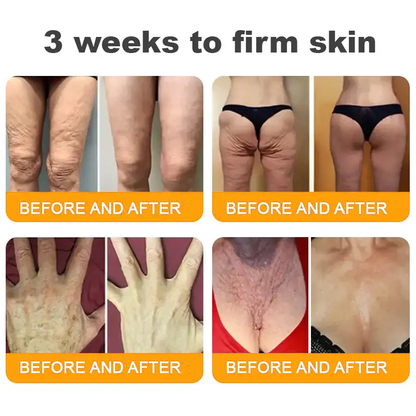 ✨FDA Approved:LOVILDS™  Bee Venom Skin Restoration Cream — 🔥Limited Time 80% OFF🔥