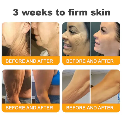 ✨FDA Approved:LOVILDS™  Bee Venom Skin Restoration Cream — 🔥Limited Time 80% OFF🔥