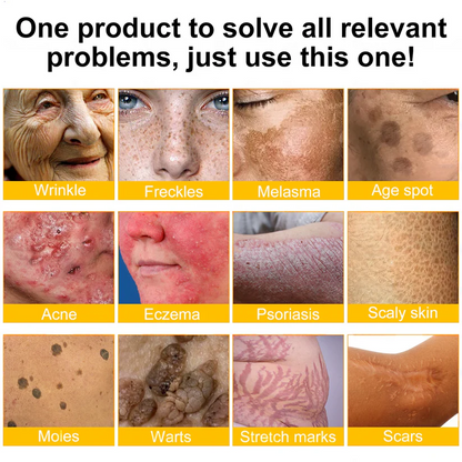 ✨FDA Approved:LOVILDS™  Bee Venom Skin Restoration Cream — 🔥Limited Time 80% OFF🔥